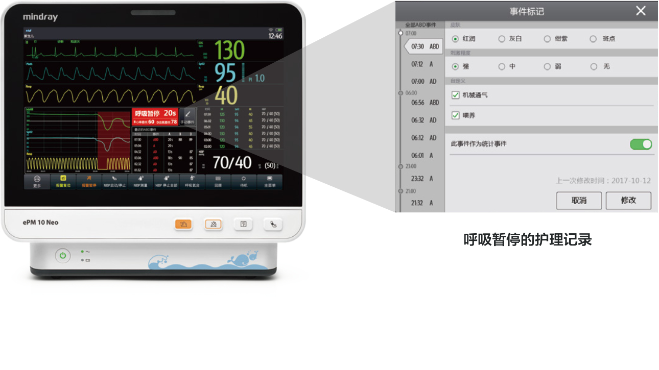 epm-10-neo-fig3-2-pc