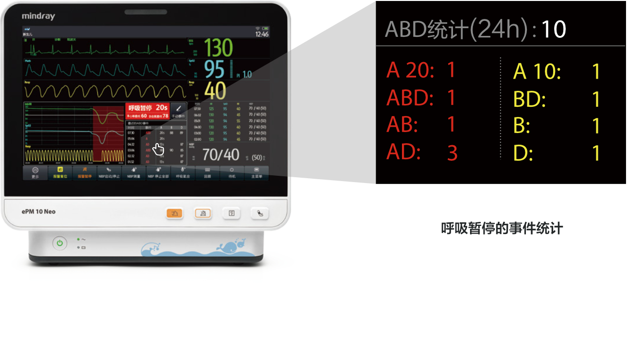 epm-10-neo-fig3-3-pc