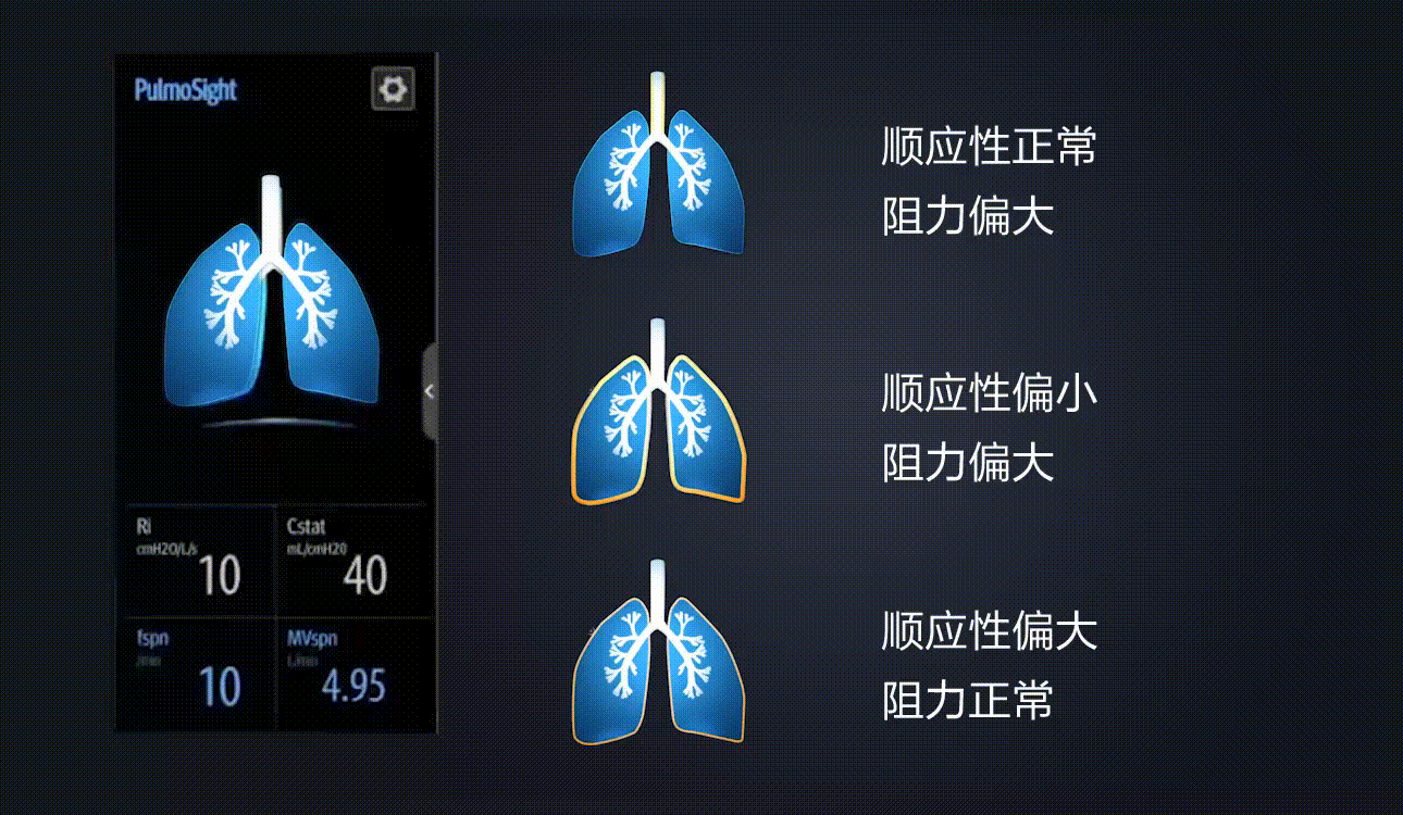 迈瑞呼吸机sv300参数图片