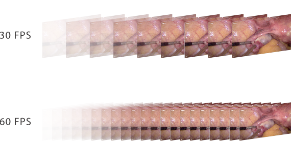 surgi-core-fig3-3-pc