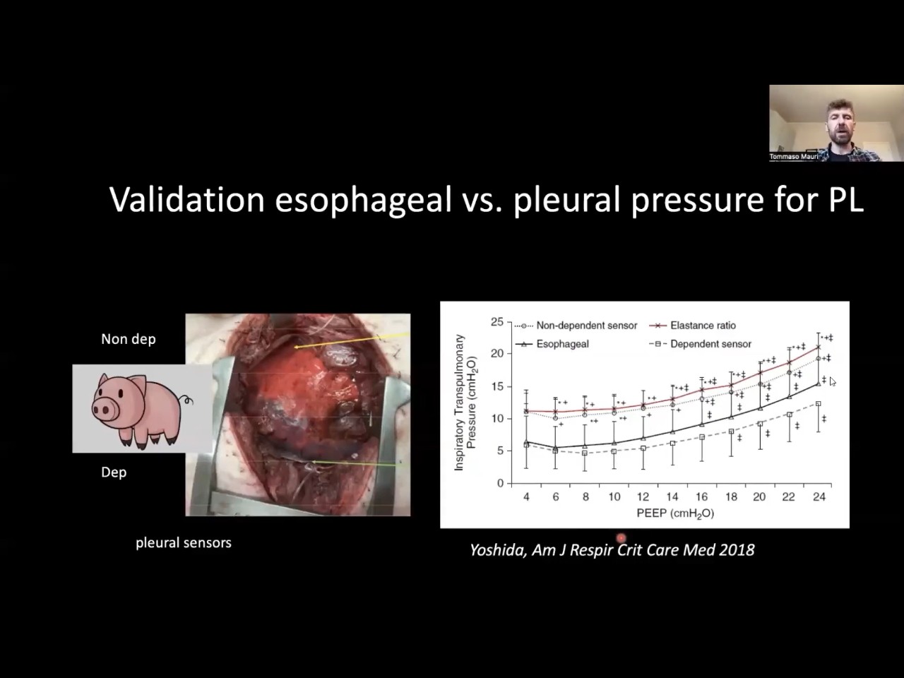 Esophageal Pressure: Drive, Effort and Asynchronies