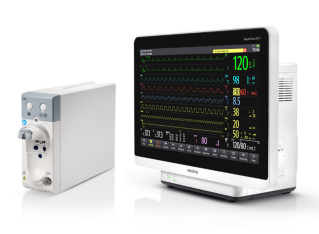 Redefining Ventilation Monitoring