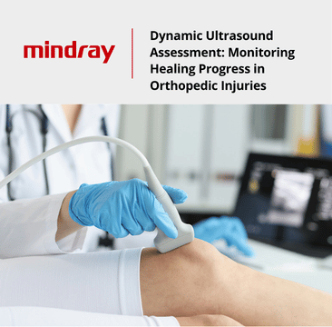 Dynamic Ultrasound Assessment: Monitoring Healing Progress in Orthopedic Injuries