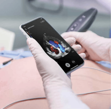 Echocardiography: Driving Better Patient Care in Cardiology Practices
