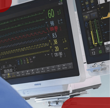 Enhancing Workflow Efficiency With Advanced Anesthesia Machines