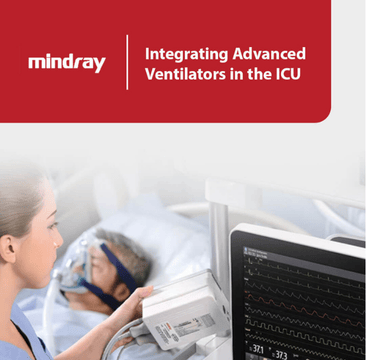 Integrating Advanced Ventilators in the ICU