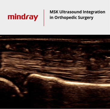 MSK Ultrasound Integration in Orthopedic Surgery