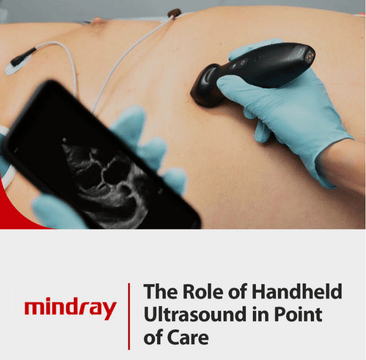 The Role of Handheld Ultrasound in Point of Care 