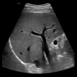 Top Considerations When Buying An Ultrasound Machine