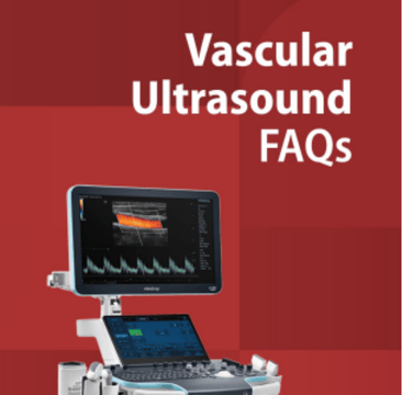 Vascular Ultrasound Questions and Answers
