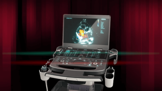 Mindray’s New Point of Care Ultrasound System Redefines What’s Possible