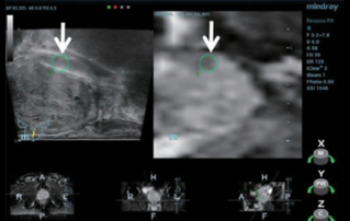 Ultrasound Journal 6 -TRUS/MRI 융합 유도 생검(Biopsy)를 통한 진단 정확성 개선