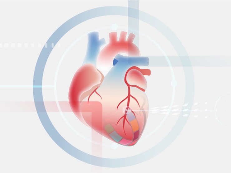 当心肌应变不再需要心电图的“入场券