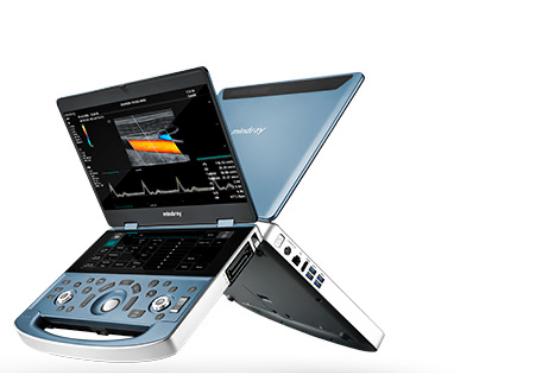 Sistema a ultrasuoni portatile serie MX